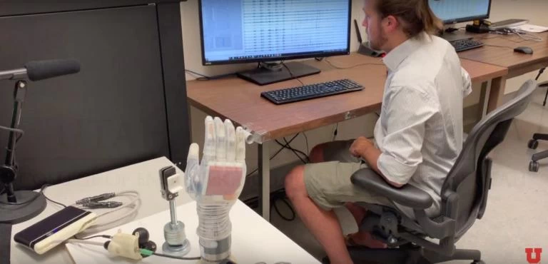 Xέρι-ρομπότ ξαναδίνει σε θύμα τροχαίου την αίσθηση της αφής! (βίντεο)